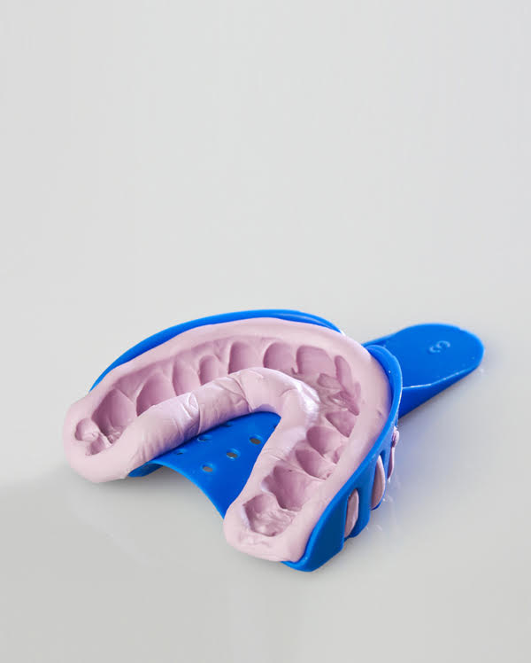 Pasta da impronta: il silcone, per assicurare accuratezza e performance anche da casa